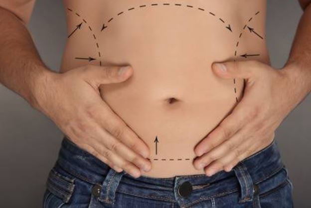 Liposuction İşlemi İle Birlikte Yapılabilir Mi?